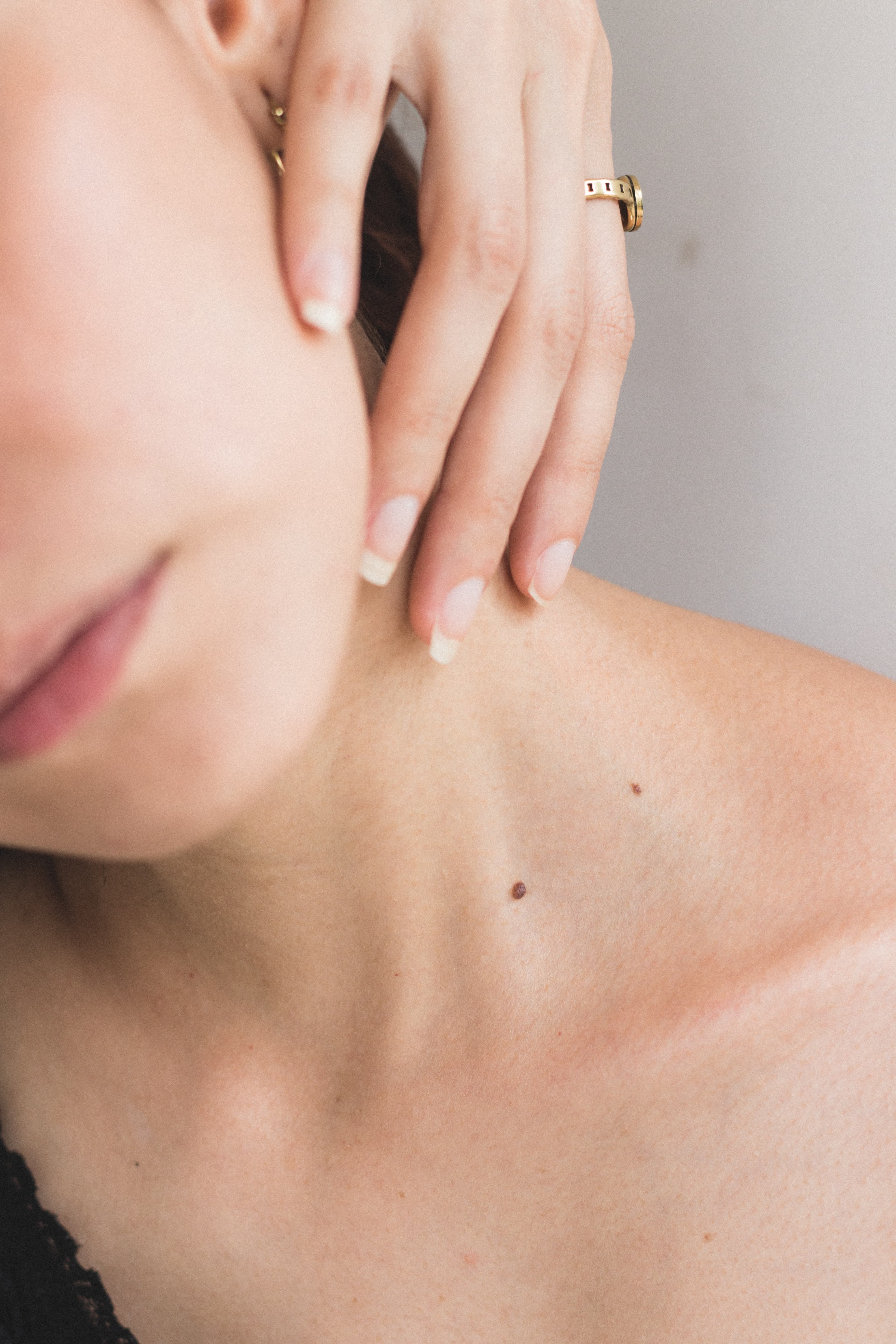 Are All Dermatologists Just Guessing?